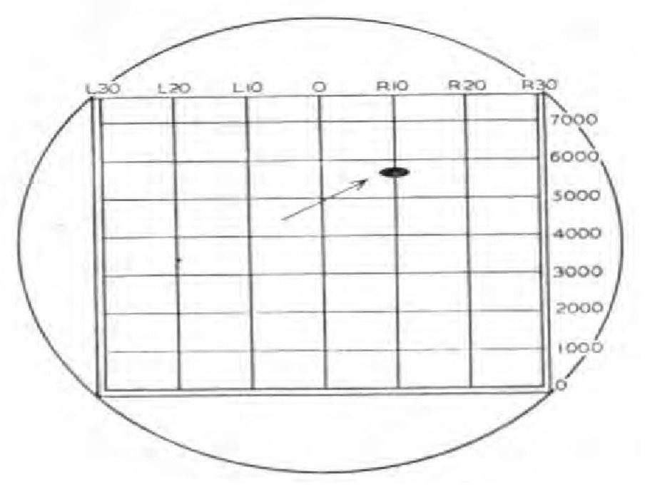 Figure 8 - Target Display on B-Scope